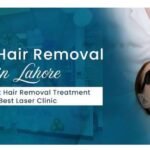 Laser Hair Removal Near Me: Find the Best Local Clinics